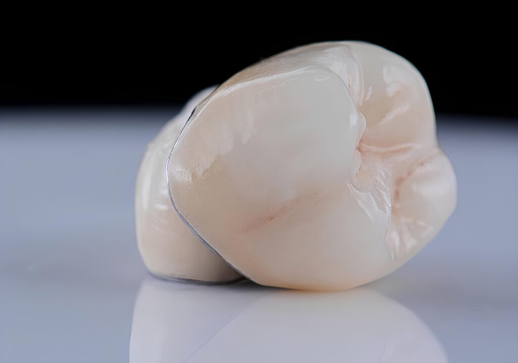 Dental Crowns Los Gatos